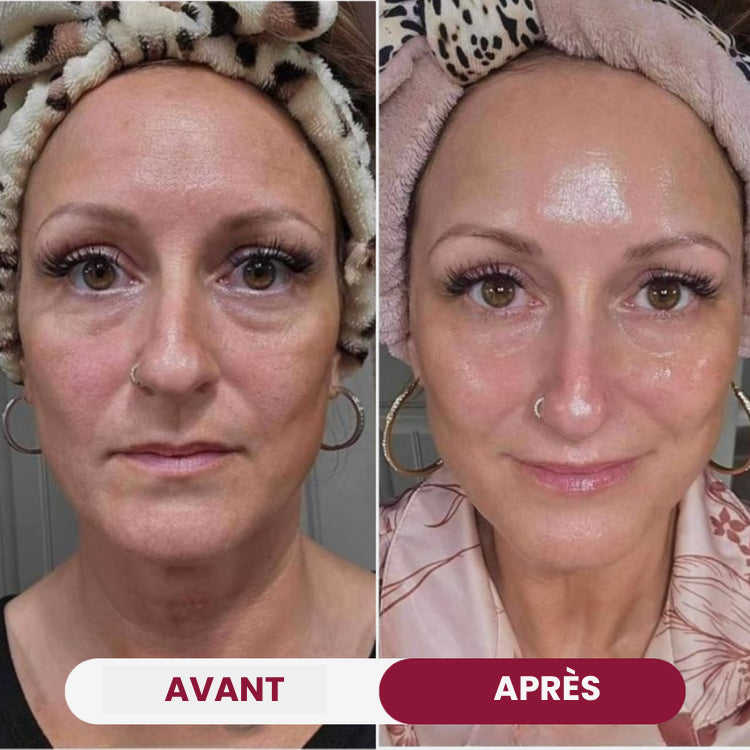 Masque Bio-Collagène - ILLORYA